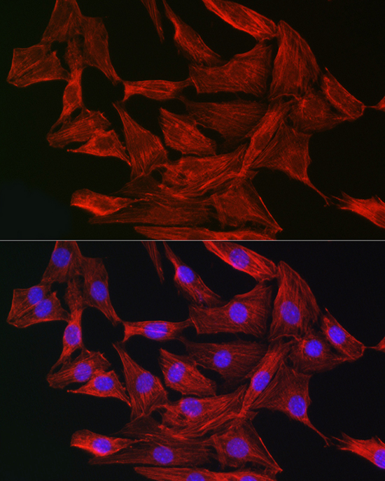 Immunofluorescence analysis of NIH-3T3 cells using Gelsolin Polyclonal Antibody at dilution of 1:50 (40x lens). Blue: DAPI for nuclear staining.