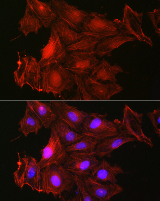 Immunofluorescence analysis of U2OS cells using Gelsolin Polyclonal Antibody at dilution of 1:50 (40x lens). Blue: DAPI for nuclear staining.