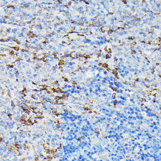 Immunohistochemistry of paraffin-embedded mouse spleen using Gelsolin Polyclonal Antibody at dilution of 1:50 (40x lens).Perform high pressure antigen retrieval with 10 mM citrate buffer pH 6.0 before commencing with IHC staining protocol.