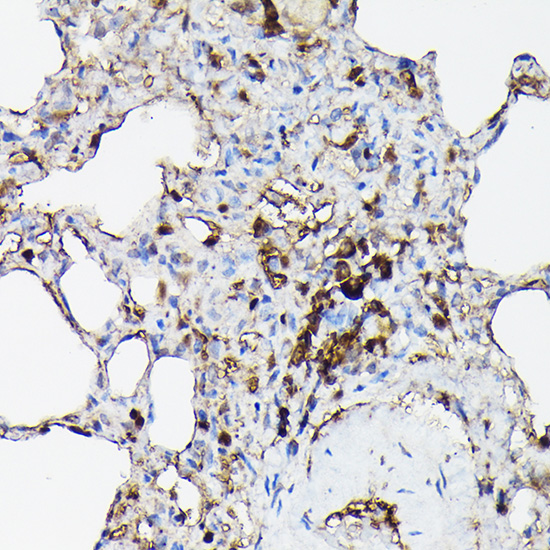 Immunohistochemistry of paraffin-embedded rat lung using Gelsolin Polyclonal Antibody at dilution of 1:50 (40x lens).Perform high pressure antigen retrieval with 10 mM citrate buffer pH 6.0 before commencing with IHC staining protocol.