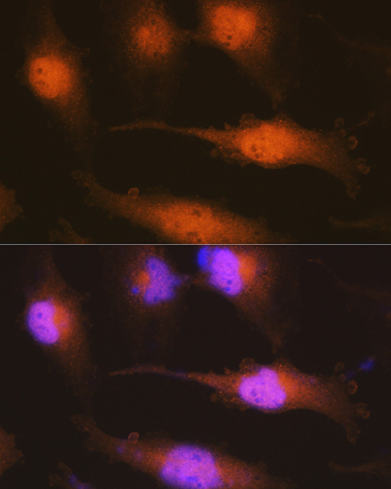 Immunofluorescence analysis of U-251 MG cells using Huntingtin Polyclonal Antibody at dilution of 1:100 (40x lens). Blue: DAPI for nuclear staining.