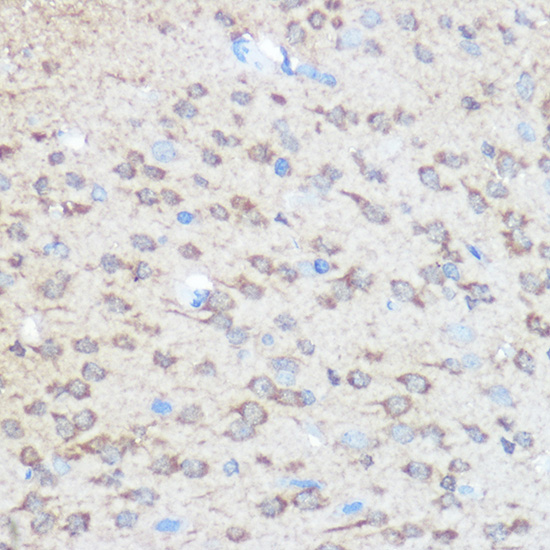 Immunohistochemistry of paraffin-embedded rat brain using Huntingtin Polyclonal Antibody at dilution of 1:100 (40x lens).Perform microwave antigen retrieval with 10 mM Tris/EDTA buffer pH 9.0 before commencing with IHC staining protocol.