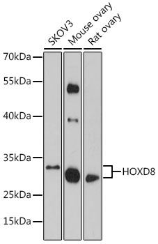 Western blot analysis of extracts of various cell lines using HOXD8 Polyclonal Antibody at 1:1000 dilution.