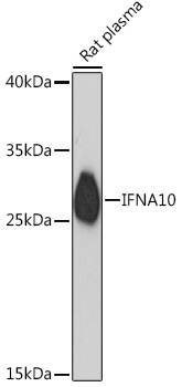 Western blot analysis of extracts of Rat plasma using IFNA10 Polyclonal Antibody at 1:1000 dilution.