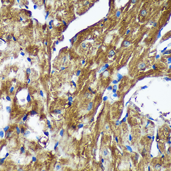 Immunohistochemistry of paraffin-embedded Mouse heart using [KO Validated] NSDHL Polyclonal Antibody at dilution of 1:100 (40x lens).Perform microwave antigen retrieval with 10 mM PBS buffer pH 7.2 before commencing with IHC staining protocol.