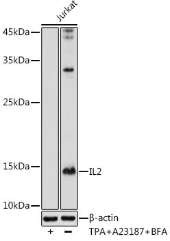 Western blot analysis of extracts of Jurkat cells using IL2 Polyclonal Antibody at 1:1000 dilution.Jurkat cells were treated by TPA (40 nM),A23187 (2μM) and Brefeldin A (300 ng / ml) for 0-24hours
