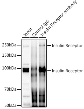 Immunoprecipitation analysis of 300ug extracts of HeLa cells using 3ug Insulin Receptor Polyclonal Antibody.Western blot was performed from the immunoprecipitate using Insulin Receptor at a dilution of 1:1000.