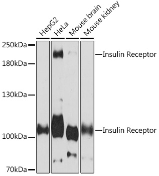 Western blot analysis of extracts of various cell lines using Insulin Receptor Polyclonal Antibody at1:3000 dilution.