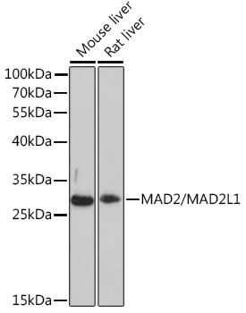 Western blot analysis of extracts of various cell lines using MAD2/MAD2/MAD2L1 Polyclonal Antibody at1:3000 dilution.