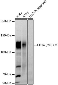 Western blot analysis of various lysates using CD146/MCAM Polyclonal Antibody at 1:1000 dilution.