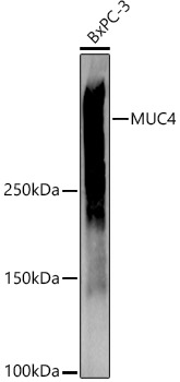 Western blot analysis of extracts of various cell lines using MUC4  Polyclonal Antibody at 1:1000 dilution.