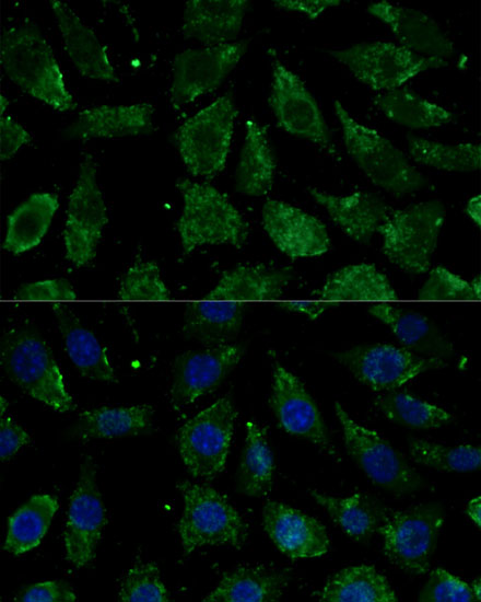 Immunofluorescence analysis of L929 cells using NDUFB1 Polyclonal Antibody at dilution of 1:100. Blue: DAPI for nuclear staining.