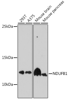 Western blot analysis of extracts of various cell lines using NDUFB1 Polyclonal Antibody at 1:1000 dilution.