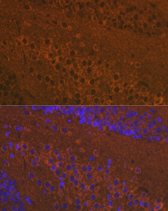 Immunofluorescence analysis of mouse brain using Mu Opioid Receptor Polyclonal Antibody at dilution of 1:100 (40x lens). Blue: DAPI for nuclear staining.