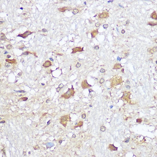 Immunohistochemistry of paraffin-embedded rat brain using Mu Opioid Receptor Polyclonal Antibody at dilution of 1:100 (40x lens).Perform microwave antigen retrieval with 10 mM Tris/EDTA buffer pH 9.0 before commencing with IHC staining protocol.