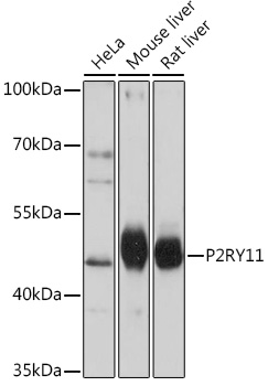 Western blot analysis of extracts of various cell lines using P2RY11 Polyclonal Antibody at1:1000 dilution.