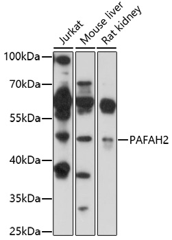 Western blot analysis of extracts of various cell lines using PAFAH2 Polyclonal Antibody at 1:1000 dilution.