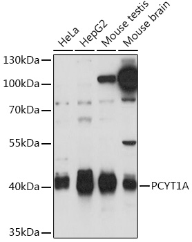 Western blot analysis of extracts of various cell lines using PCYT1A Polyclonal Antibody at1:1000 dilution.