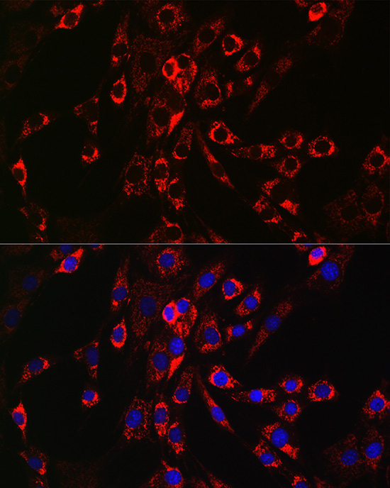 Immunofluorescence analysis of NIH/3T3 cells using HB-EGF Polyclonal Antibody at dilution of 1:100 (40x lens). Blue: DAPI for nuclear staining.