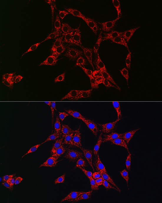 Immunofluorescence analysis of PC-12 cells using HB-EGF Polyclonal Antibody at dilution of 1:100 (40x lens). Blue: DAPI for nuclear staining.