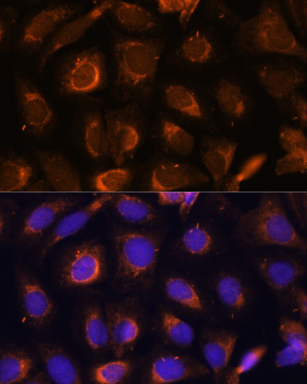 Immunofluorescence analysis of U-2 OS cells using SHMT1 Polyclonal Antibody at dilution of 1:100. Blue: DAPI for nuclear staining.