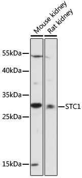 Western blot analysis of extracts of various cell lines using STC1 Polyclonal Antibody at 1:1000 dilution.