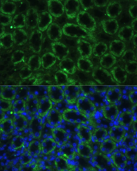 Immunofluorescence analysis of mouse kidney using TBCE Polyclonal Antibody at dilution of 1:100. Blue: DAPI for nuclear staining.