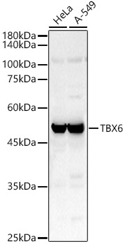 Western blot analysis of various lysates using TBX6 Polyclonal Antibody at 1:500 dilution.