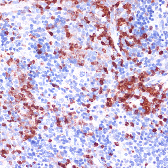 Immunohistochemistry of paraffin-embedded mouse spleen using WIPF1 Polyclonal Antibody at dilution of 1:100 (40x lens).Perform microwave antigen retrieval with 10 mM PBS buffer pH 7.2 before commencing with IHC staining protocol.