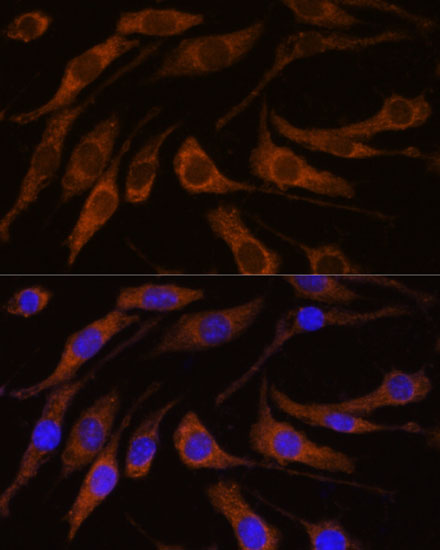 Immunofluorescence analysis of L929 cells using BRPF1 Polyclonal Antibody at dilution of 1:100. Blue: DAPI for nuclear staining.