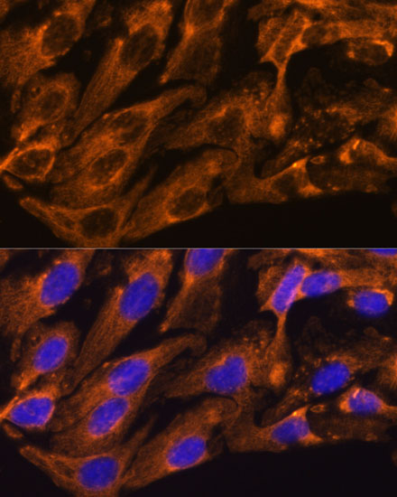 Immunofluorescence analysis of U2OS cells using BRPF1 Polyclonal Antibody at dilution of 1:100. Blue: DAPI for nuclear staining.