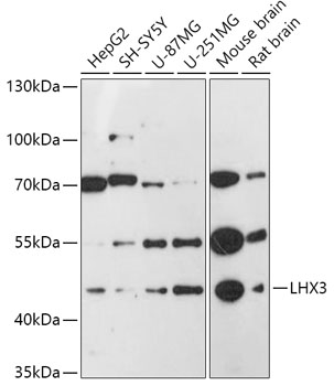 Western blot analysis of extracts of various cell lines using LHX3 Polyclonal Antibody at 1:1000 dilution.