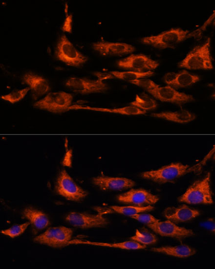 Immunofluorescence analysis of C6 cells using ACOX3 Polyclonal Antibody at dilution of 1:100. Blue: DAPI for nuclear staining.