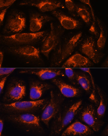 Immunofluorescence analysis of U2OS cells using ACOX3 Polyclonal Antibody at dilution of 1:100. Blue: DAPI for nuclear staining.