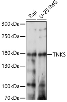 Western blot analysis of extracts of various cell lines using TNKS Polyclonal Antibody at 1:1000 dilution.