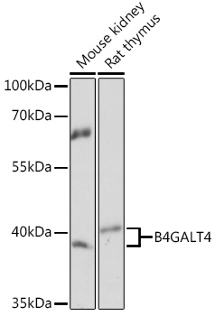 Western blot analysis of extracts of various cell lines using B4GALT4 Polyclonal Antibody at1:1000 dilution.