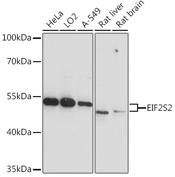 Western blot analysis of extracts of various cell lines using EIF2S2 Polyclonal Antibody at1:3000 dilution.