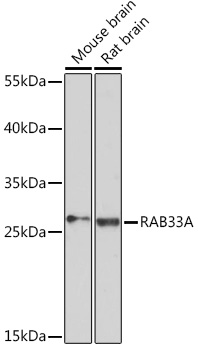 Western blot analysis of extracts of various cell lines using RAB33A Polyclonal Antibody at1:3000 dilution.