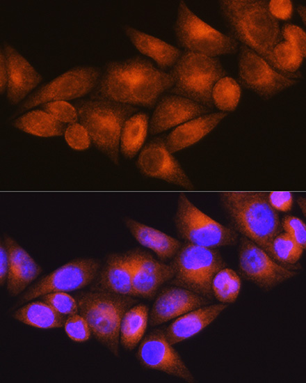 Immunofluorescence analysis of HeLa cells using WFS1 Polyclonal Antibody at dilution of 1:100 (40x lens). Blue: DAPI for nuclear staining.