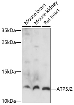 Western blot analysis of extracts of various cell lines using ATP5J2 Polyclonal Antibody at 1:1000 dilution.