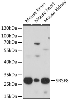 Western blot analysis of extracts of various cell lines using SRSF8 Polyclonal Antibody at1:1000 dilution.