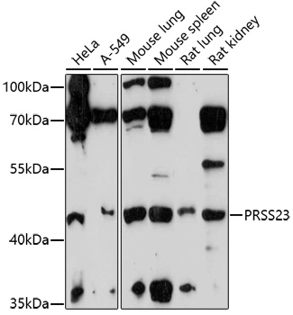 Western blot analysis of extracts of various cell lines using PRSS23 Polyclonal Antibody at 1:1000 dilution.