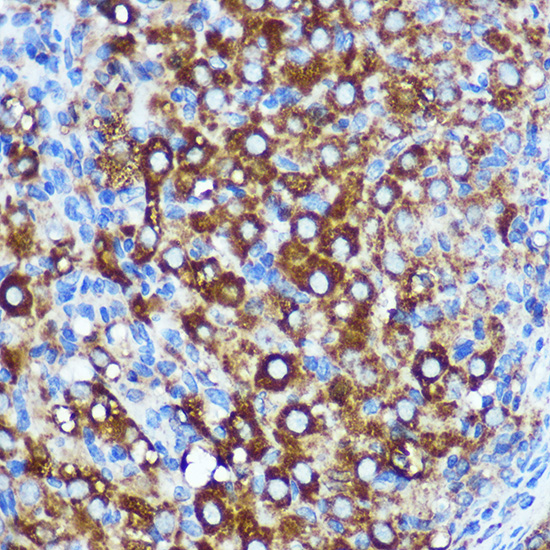 Immunohistochemistry of paraffin-embedded Rat ovary using WWC1 Polyclonal Antibody at dilution of 1:100 (40x lens).Perform microwave antigen retrieval with 10 mM PBS buffer pH 7.2 before commencing with IHC staining protocol.