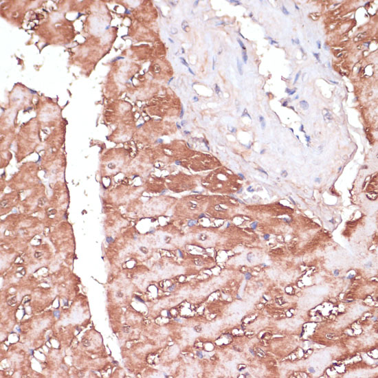 Immunohistochemistry of paraffin-embedded rat heart using GEMIN5 Polyclonal Antibody at dilution of 1:100 (40x lens).Perform microwave antigen retrieval with 10 mM PBS buffer pH 7.2 before commencing with IHC staining protocol.