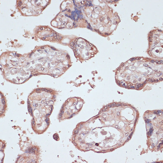 Immunohistochemistry of paraffin-embedded human placenta using GEMIN5 Polyclonal Antibody at dilution of 1:100 (40x lens).Perform microwave antigen retrieval with 10 mM PBS buffer pH 7.2 before commencing with IHC staining protocol.