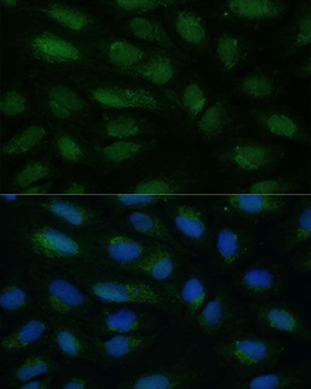 Immunofluorescence analysis of U2OS cells using HIBCH Polyclonal Antibody at dilution of 1:100. Blue: DAPI for nuclear staining.