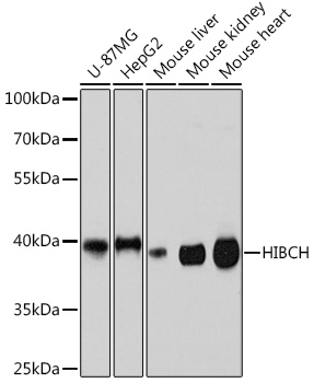 Western blot analysis of extracts of various cell lines using HIBCH Polyclonal Antibody at1:3000 dilution.