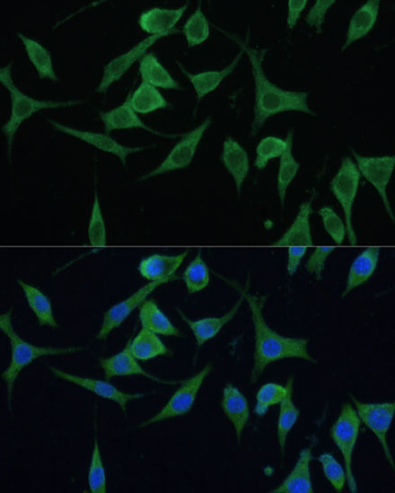 Immunofluorescence analysis of L929 cells using CNNM1 Polyclonal Antibody at dilution of 1:100. Blue: DAPI for nuclear staining.