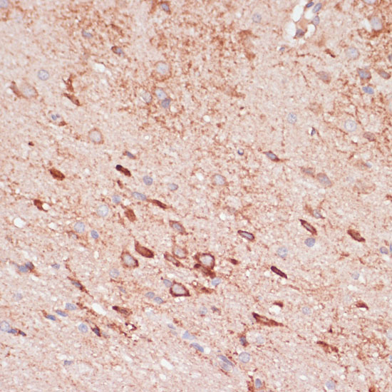 Immunohistochemistry of paraffin-embedded rat brain using OR10H3 Polyclonal Antibody at dilution of 1:100 (40x lens).Perform microwave antigen retrieval with 10 mM PBS buffer pH 7.2 before commencing with IHC staining protocol.