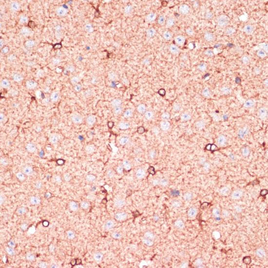 Immunohistochemistry of paraffin-embedded mouse brain using OR10H3 Polyclonal Antibody at dilution of 1:100 (40x lens).Perform microwave antigen retrieval with 10 mM PBS buffer pH 7.2 before commencing with IHC staining protocol.